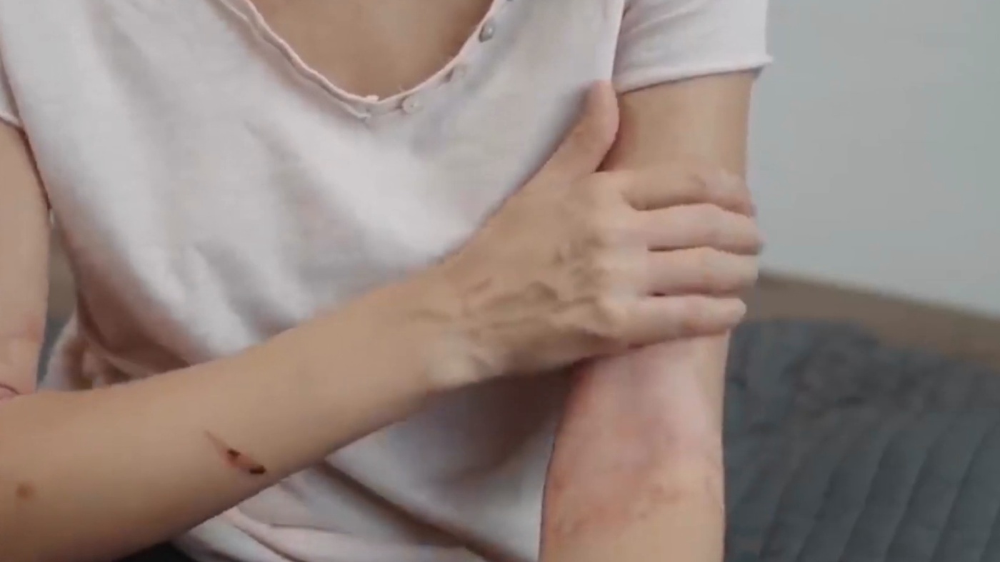 Профилактика кожных заболеваний 