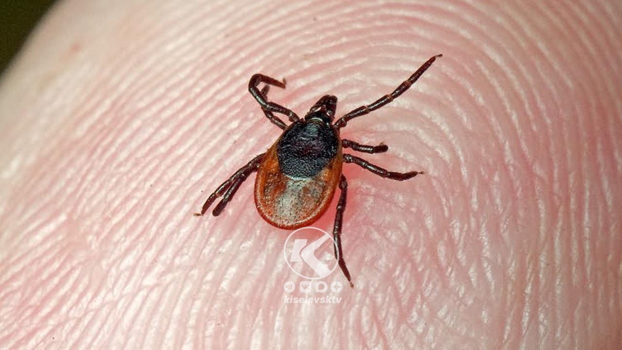 556 киселевчан были укушены в этом сезоне клещом